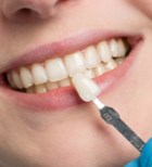 שיניים: מה ההבדל בין ציפוי קומפוזיט לבין ציפוי חרסינה?-תמונה